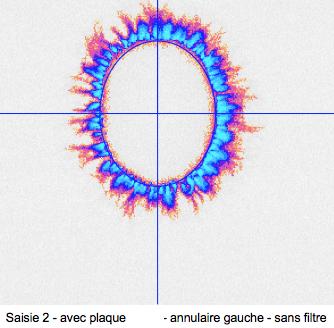 GDVannulairegaucheavec